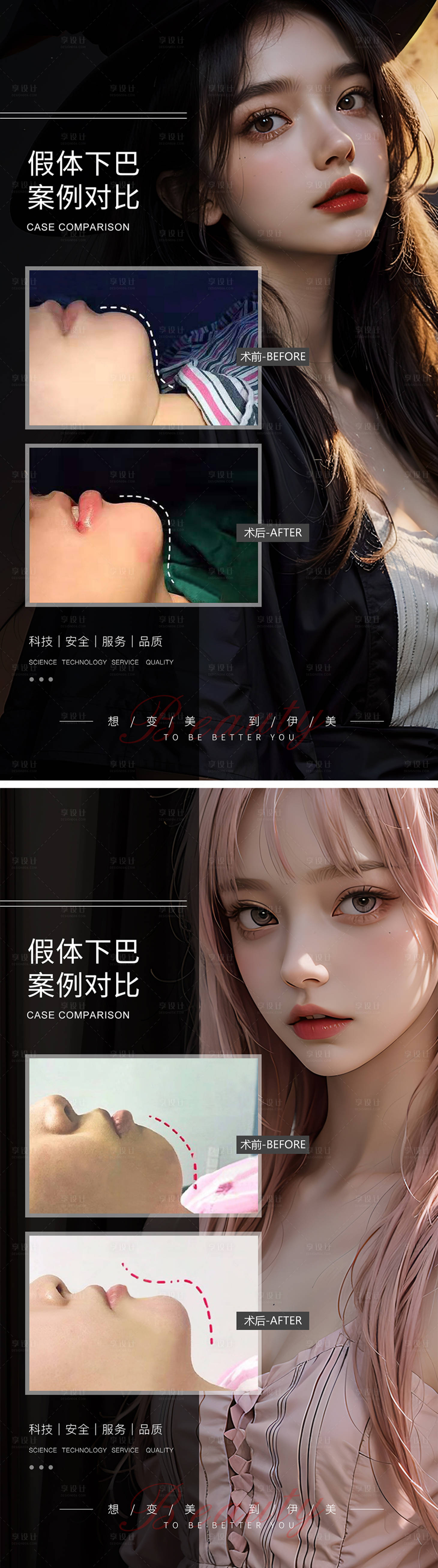 源文件下载【享设计】搜索编号：33460019306592217【假体下巴案例对比海报】