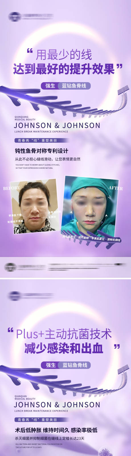 源文件下载【强生鱼骨线科普海报】编号：99470019536623804
