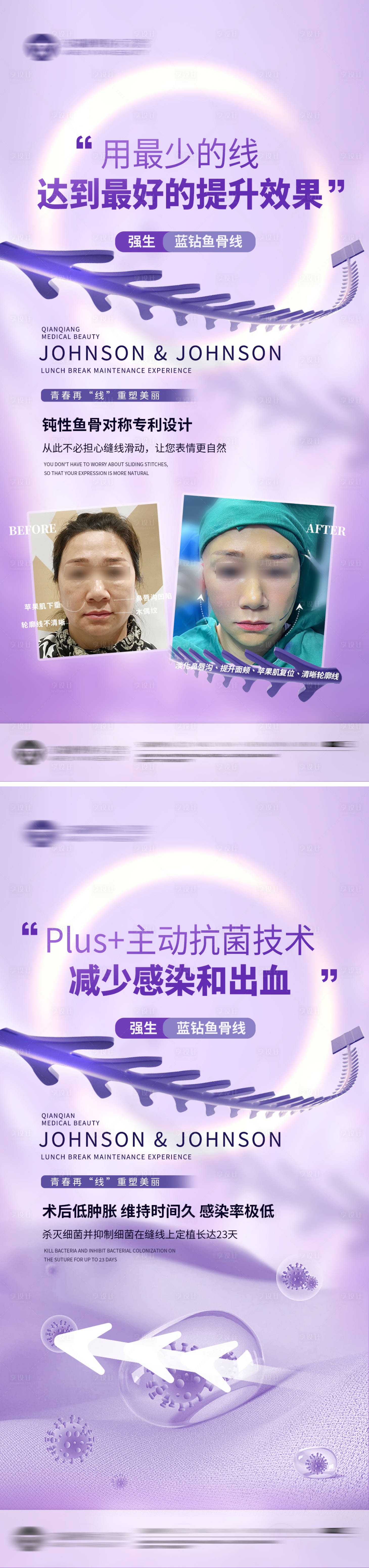 源文件下载【享设计】搜索编号：99470019536623804【强生鱼骨线科普海报】