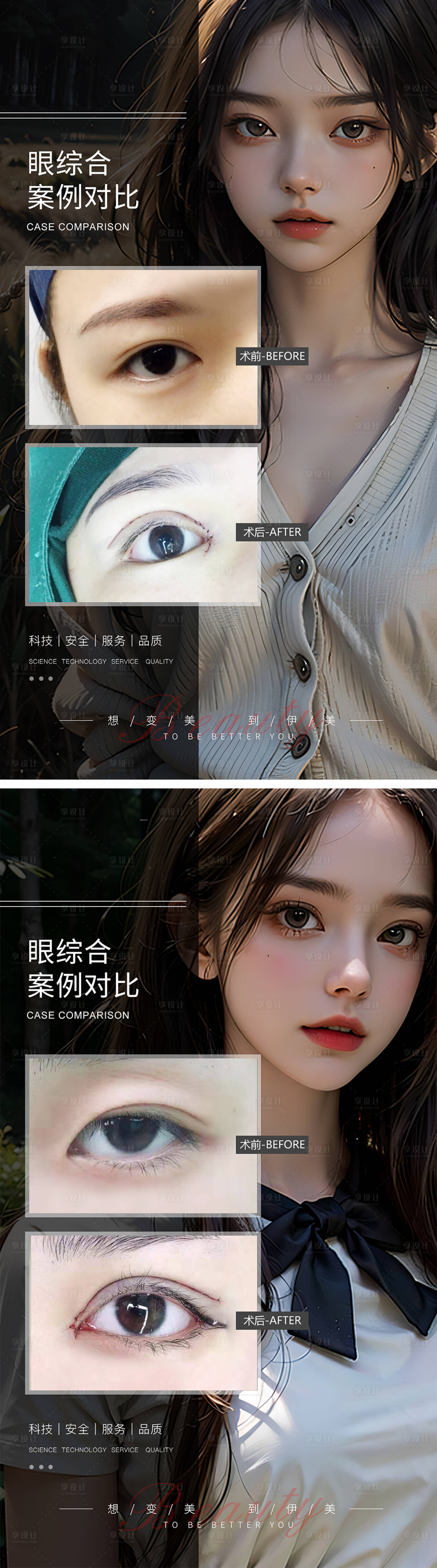 源文件下载【眼综合案例对比】编号：86910019304807039