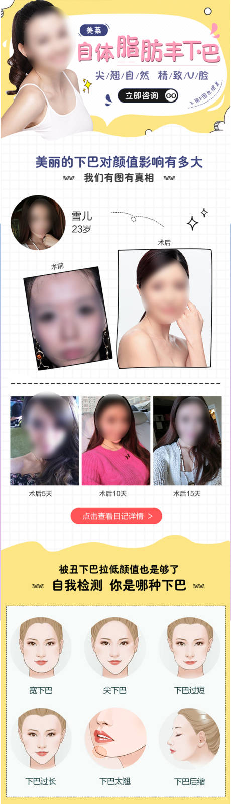 源文件下载【享设计】搜索编号：79410019219492856【医美自体脂肪丰下巴详情页】