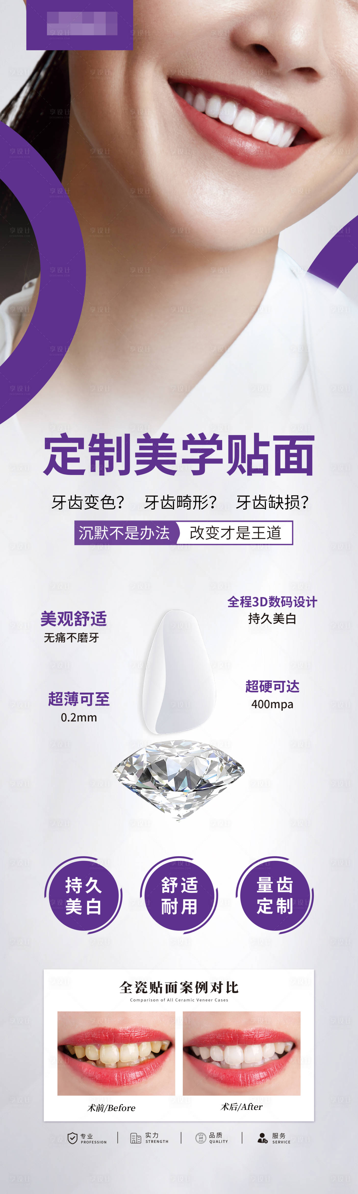 源文件下载【享设计】搜索编号：93740019312938422【牙齿贴面海报】