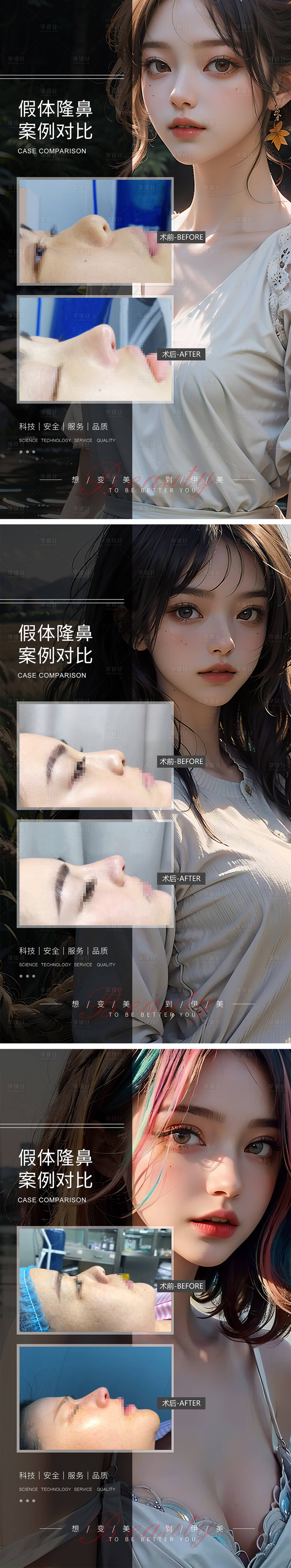 源文件下载【享设计】搜索编号：18890019304647687【假体隆鼻案例对比海报】
