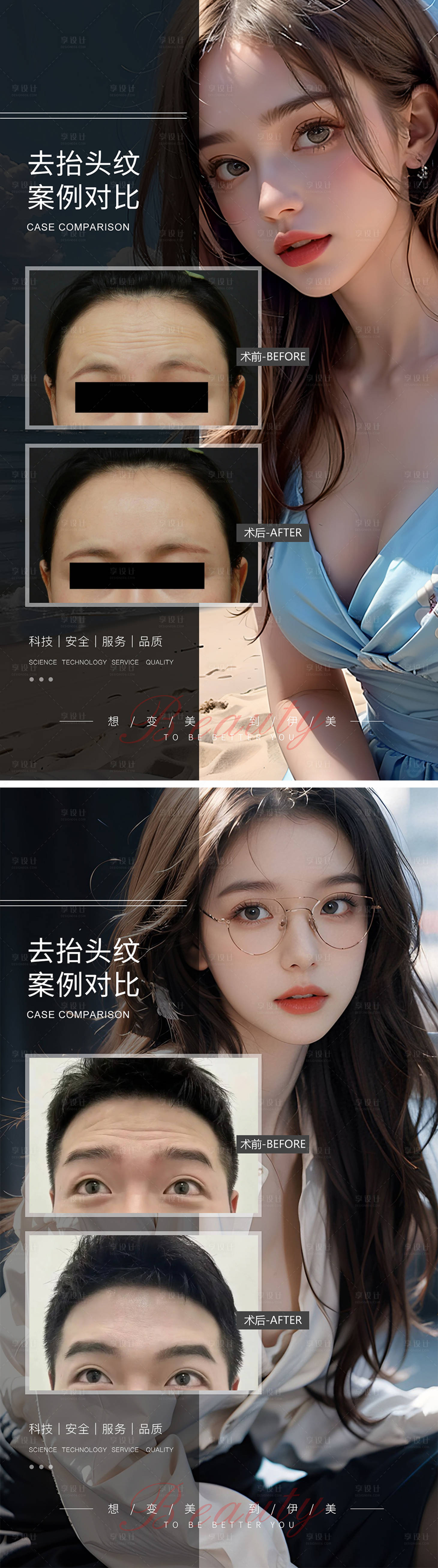 源文件下載【享設(shè)計(jì)】搜索編號(hào)：71060019248104319【去抬頭紋案例對(duì)比】