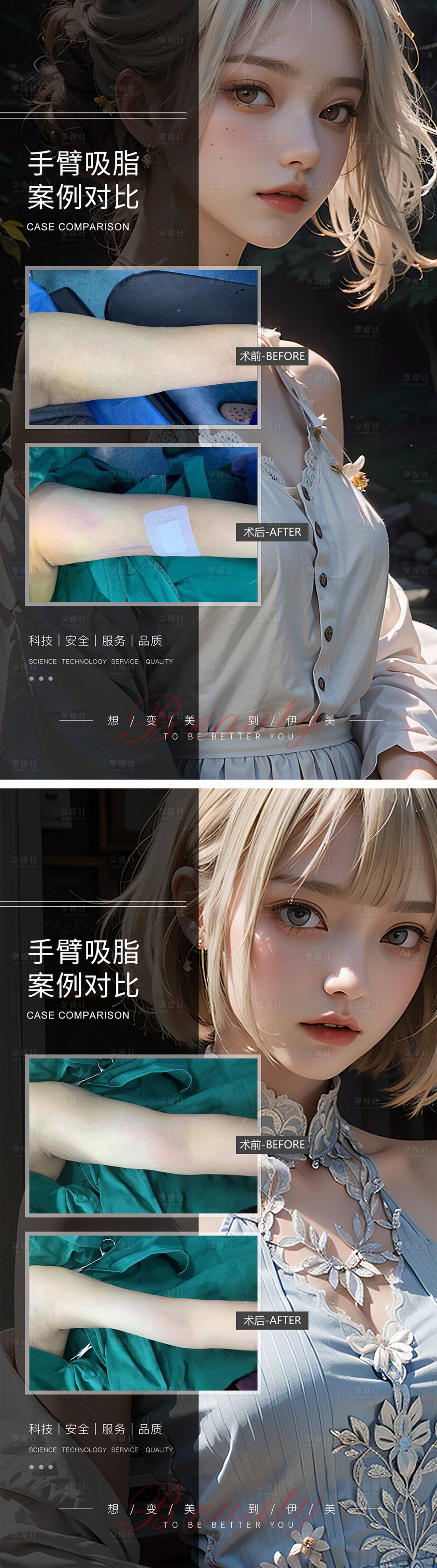 源文件下載【享設(shè)計(jì)】搜索編號(hào)：75670019311689778【手臂吸脂案例對(duì)比】