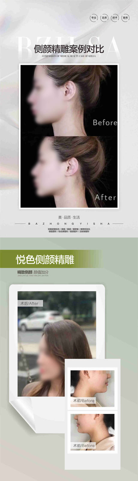 源文件下载【医美案例系列】编号：47290019191188200