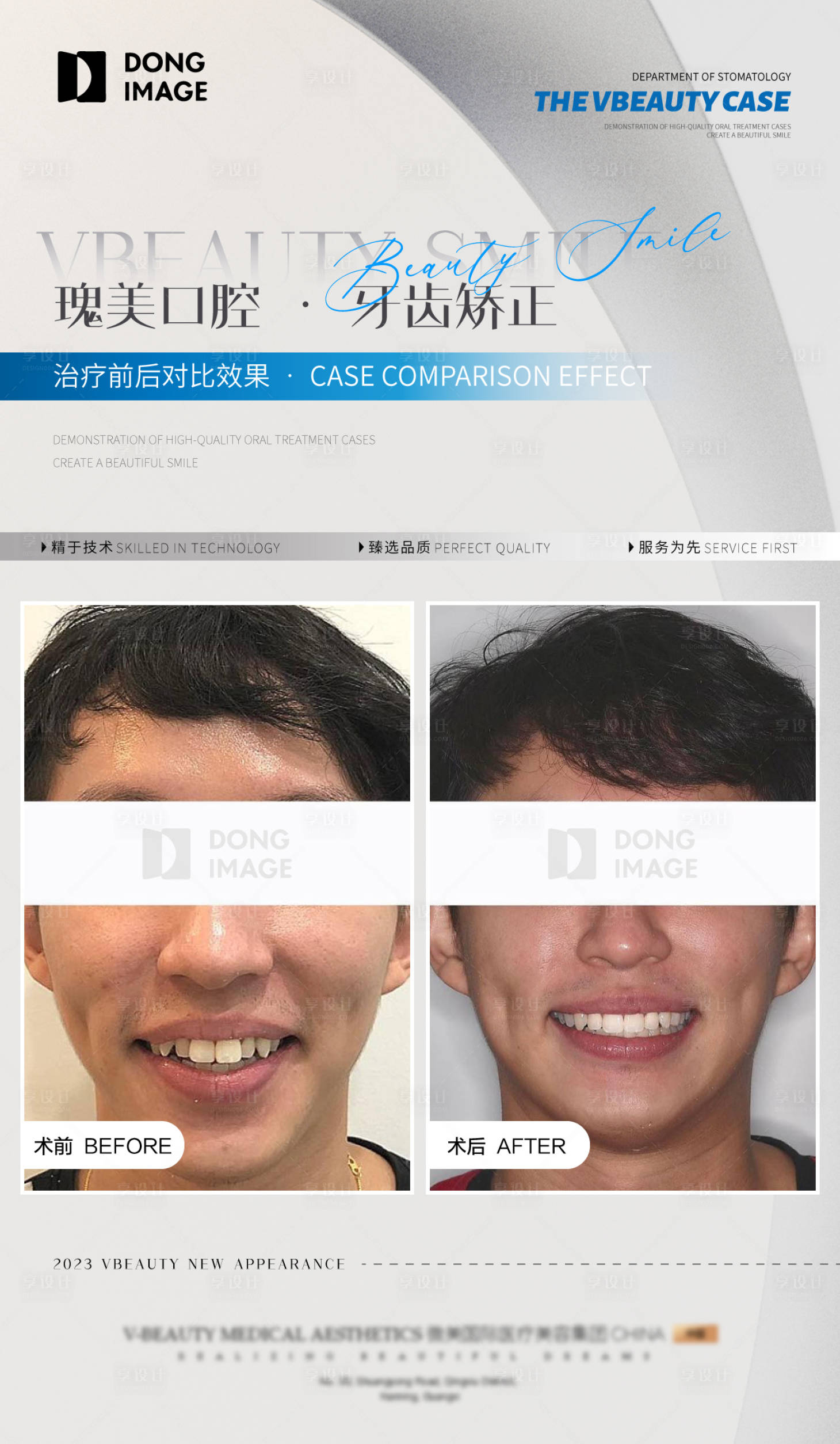 源文件下载【享设计】搜索编号：61620019358228432【口腔牙科矫正案例对比宣传海报】
