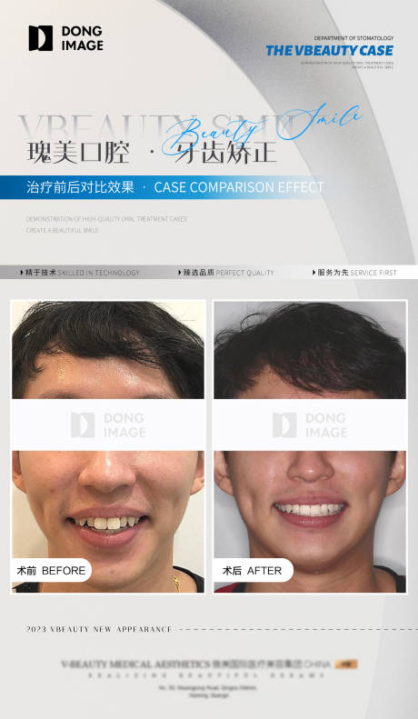 编号：20230915141104306【享设计】源文件下载-口腔牙科矫正案例对比宣传海报