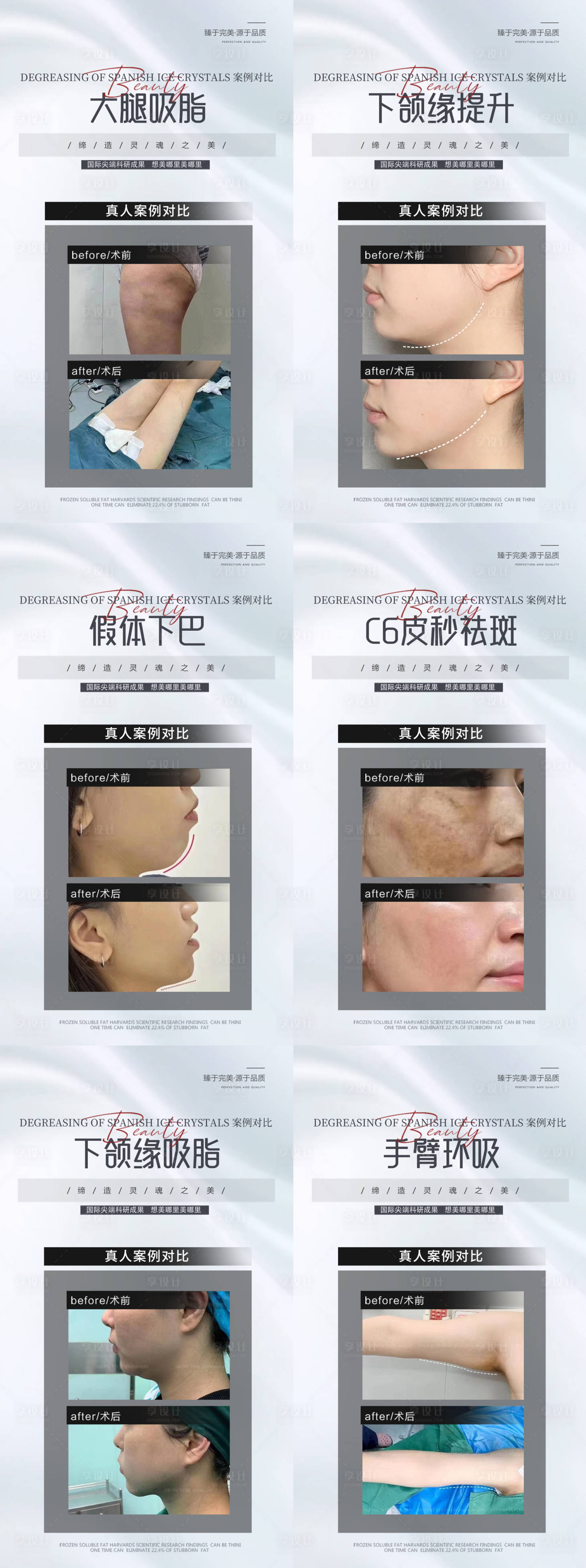 源文件下载【享设计】搜索编号：55730019573492392【医美案例对比海报】