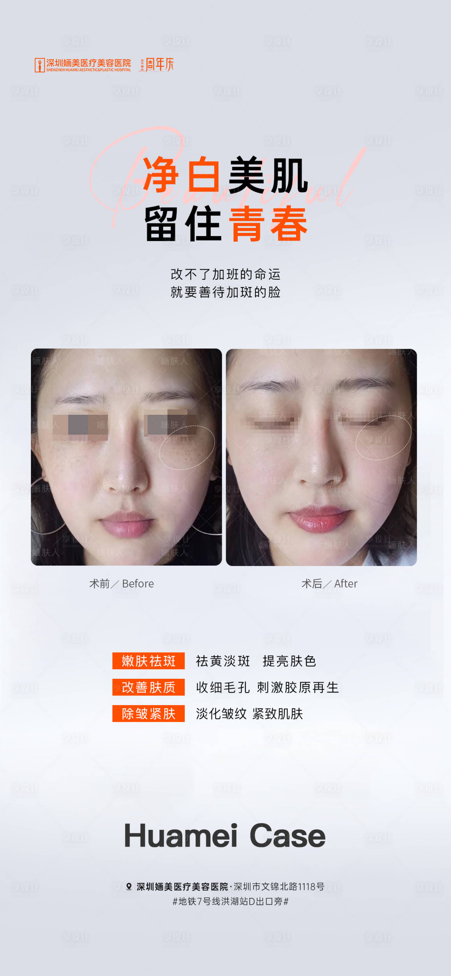 源文件下载【享设计】搜索编号：77900019311904575【案例海报】