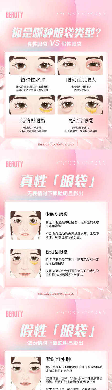 源文件下载【医美科普眼袋海报】编号：20610019255694397