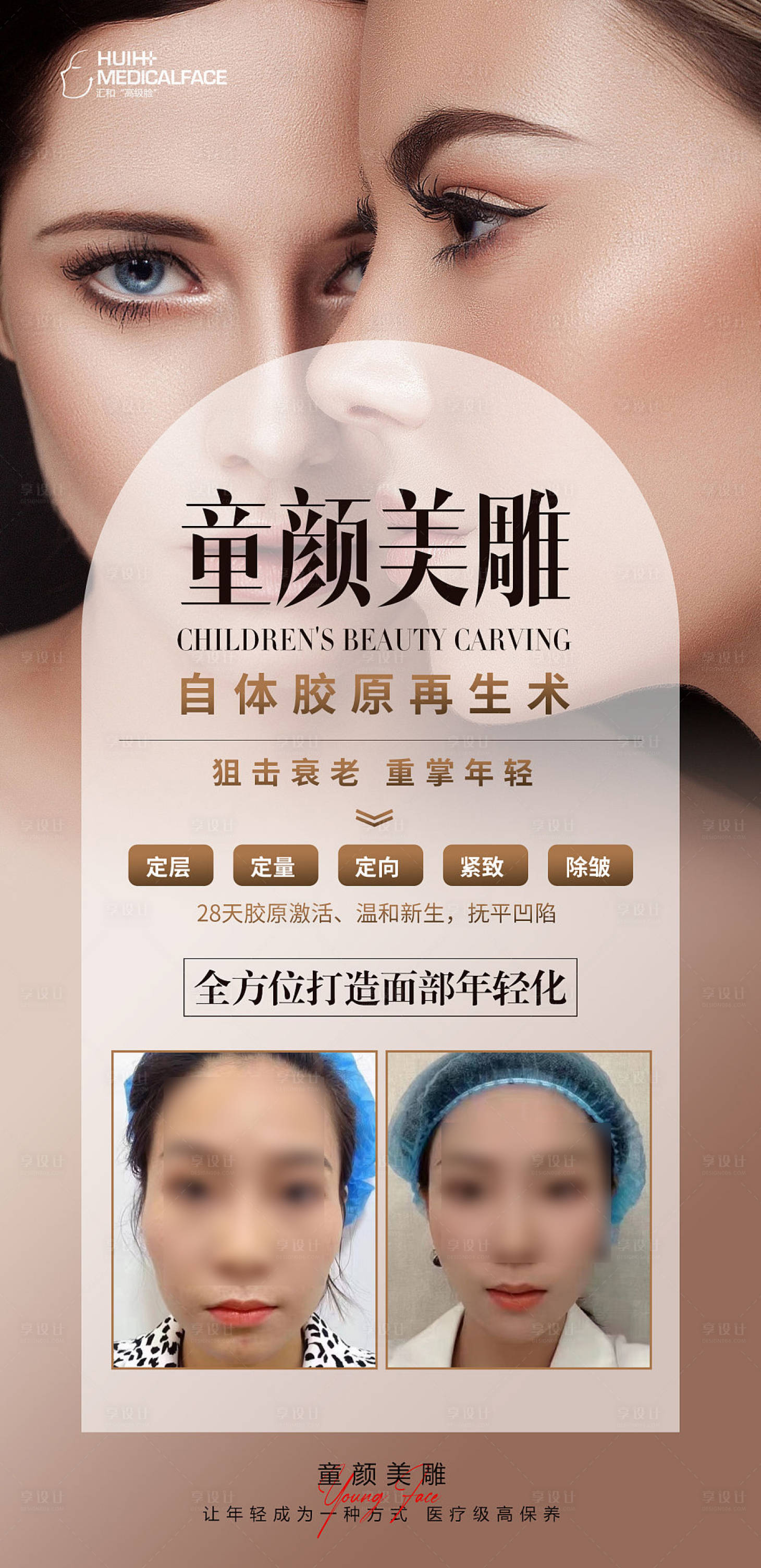 源文件下载【轻医美童颜美雕科普海报】编号：13360019161492161