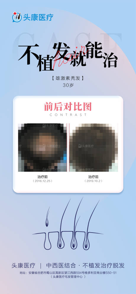 源文件下载【医疗对比海报】编号：24860019276611035