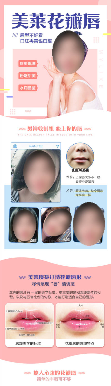 源文件下载【医美花瓣唇详情页】编号：85560019196541717