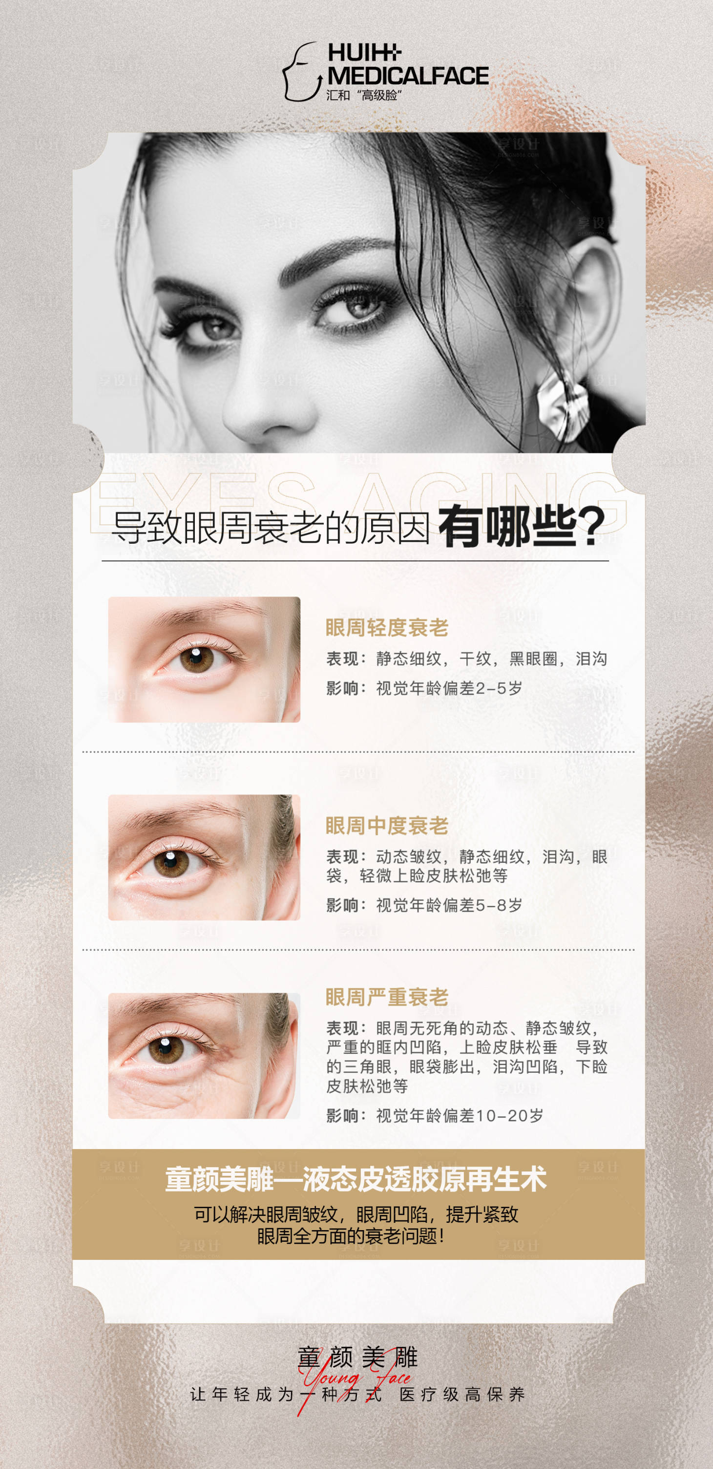 源文件下載【享設計】搜索編號：39580019155625128【醫美眼部衰老科普】