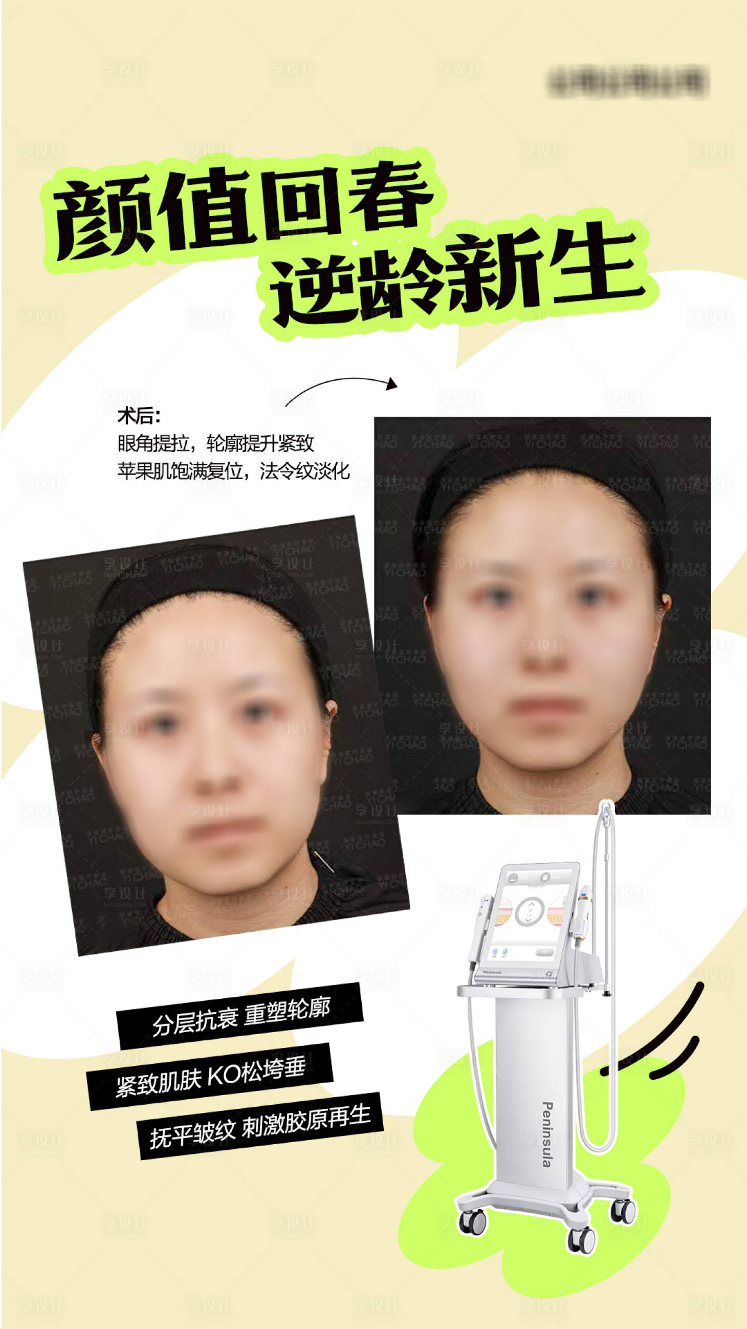源文件下载【医美超声炮抗衰案例对比】编号：94470019460437337