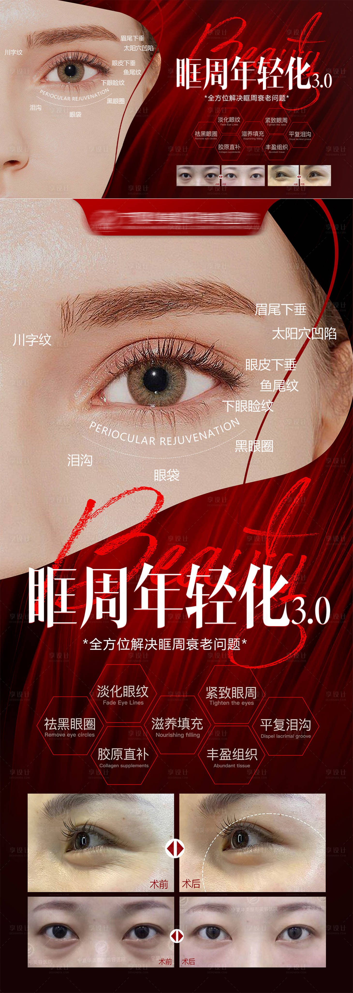源文件下载【享设计】搜索编号：98010019364972048【眶周年轻化海报】
