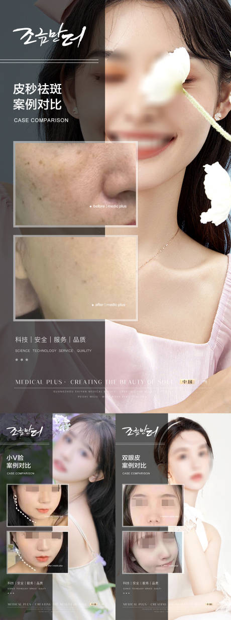 源文件下载【医美案例对比海报】编号：90010019117847484