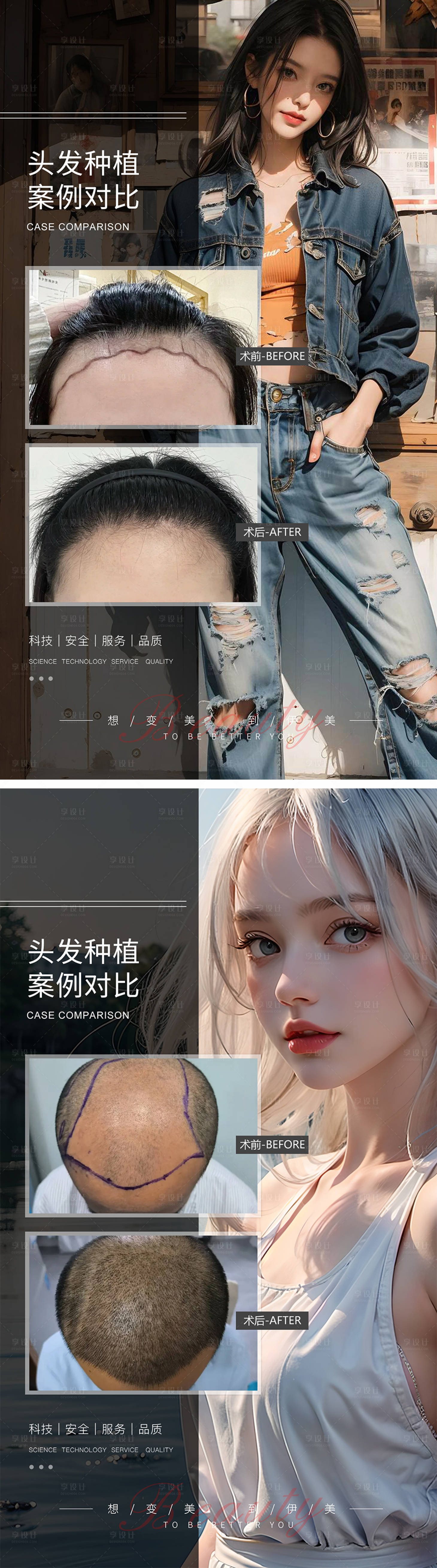 源文件下载【享设计】搜索编号：53520019284299033【头发种植案例对比系列海报】