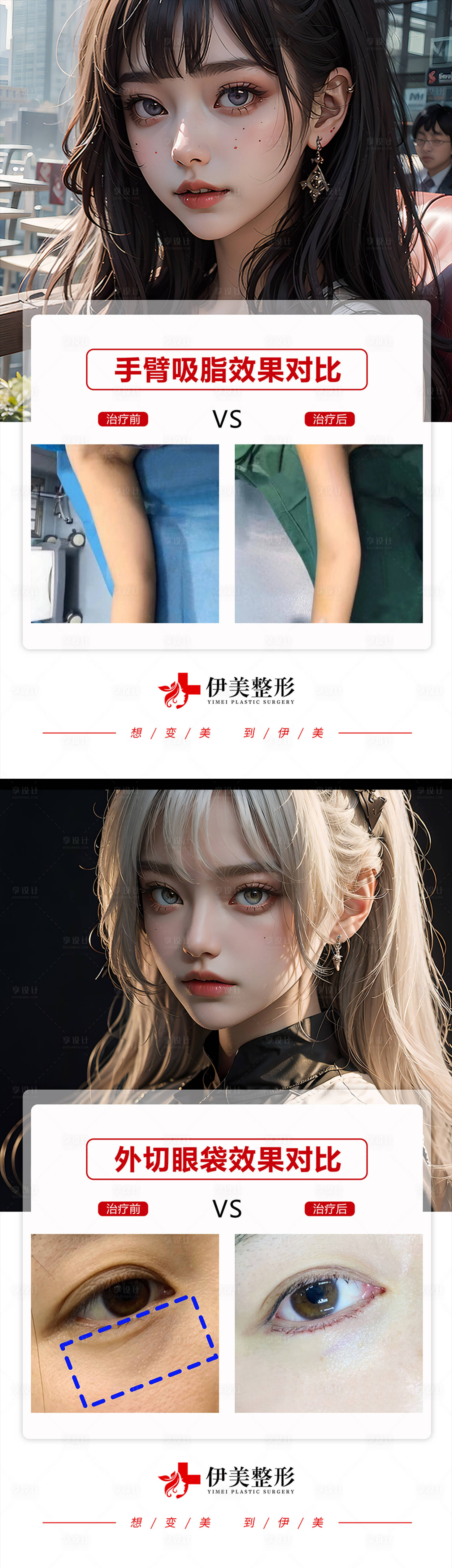 源文件下载【享设计】搜索编号：41440019431375356【手臂吸脂眼袋案例对比系列】