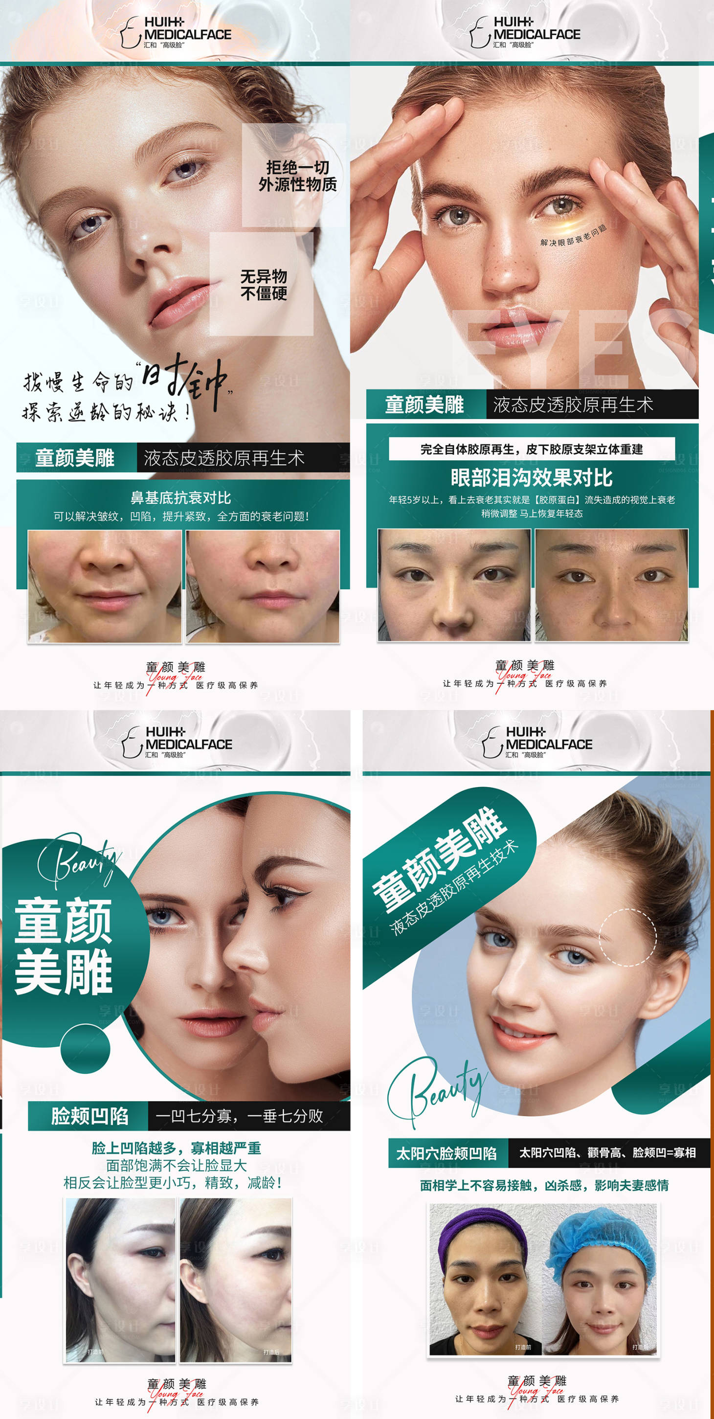 源文件下載【享設(shè)計】搜索編號：15650019155727032【醫(yī)美童顏美雕系列海報】