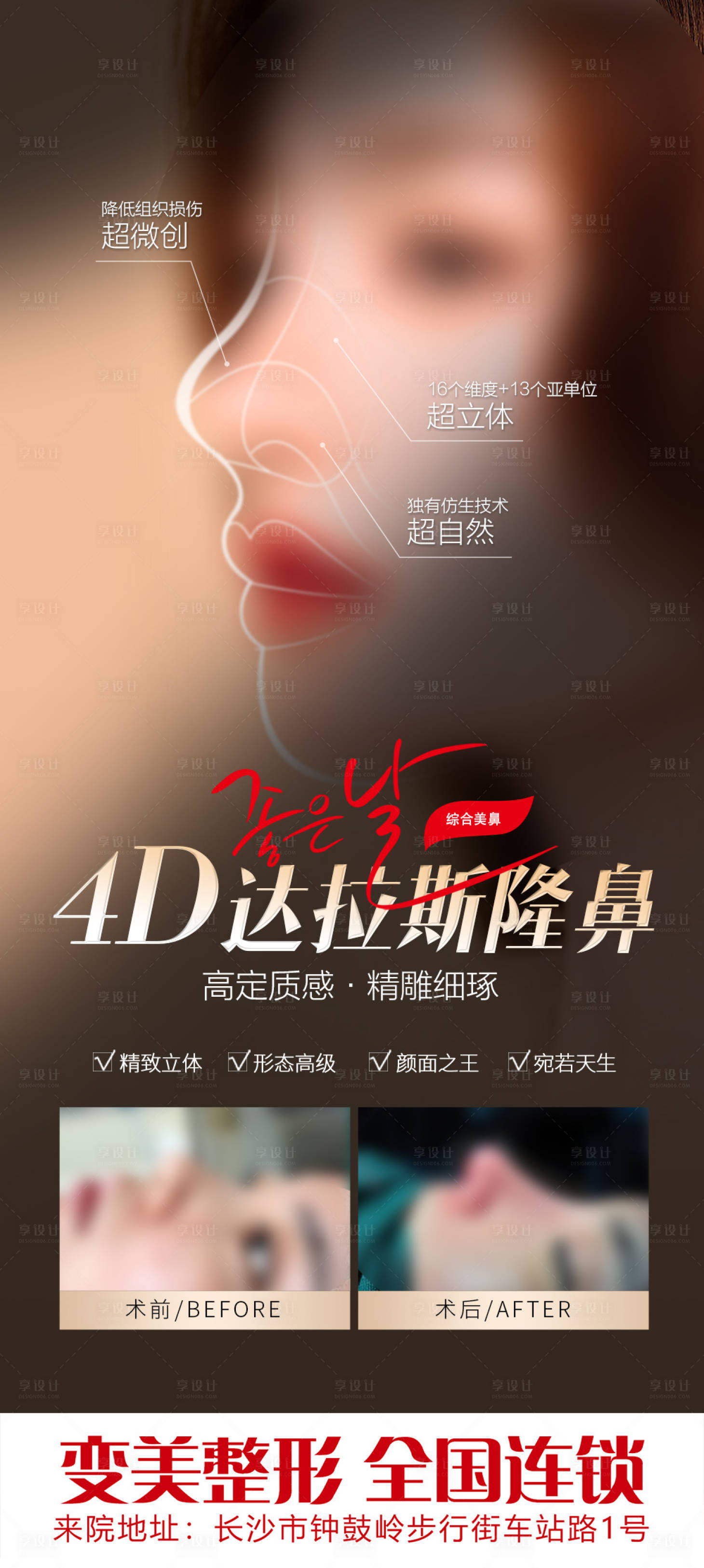 源文件下载【医美综合隆鼻案例宣传海报】编号：51350019384254444