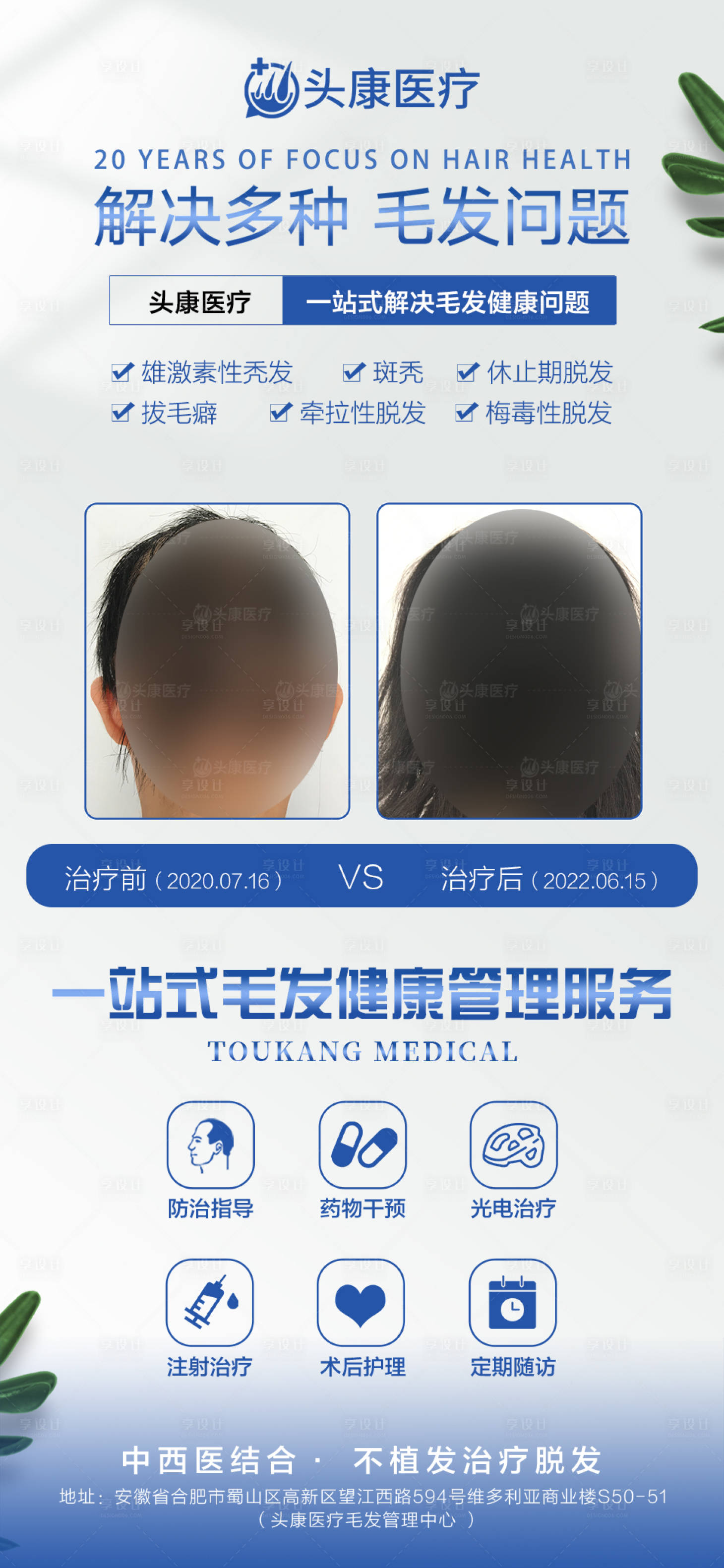 源文件下载【享设计】搜索编号：43360019586733142【脱发案例对比图海报】