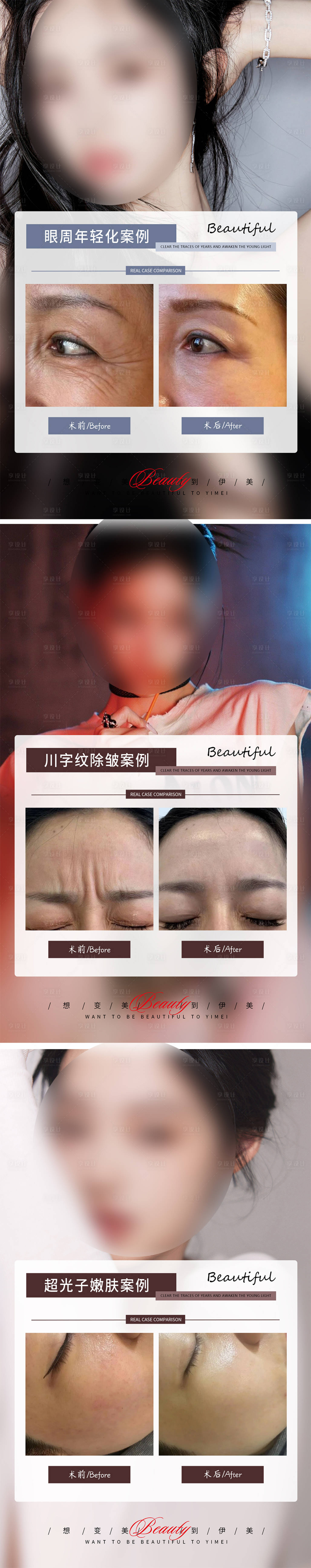源文件下载【享设计】搜索编号：39560019120244138【眼周年轻化海报】