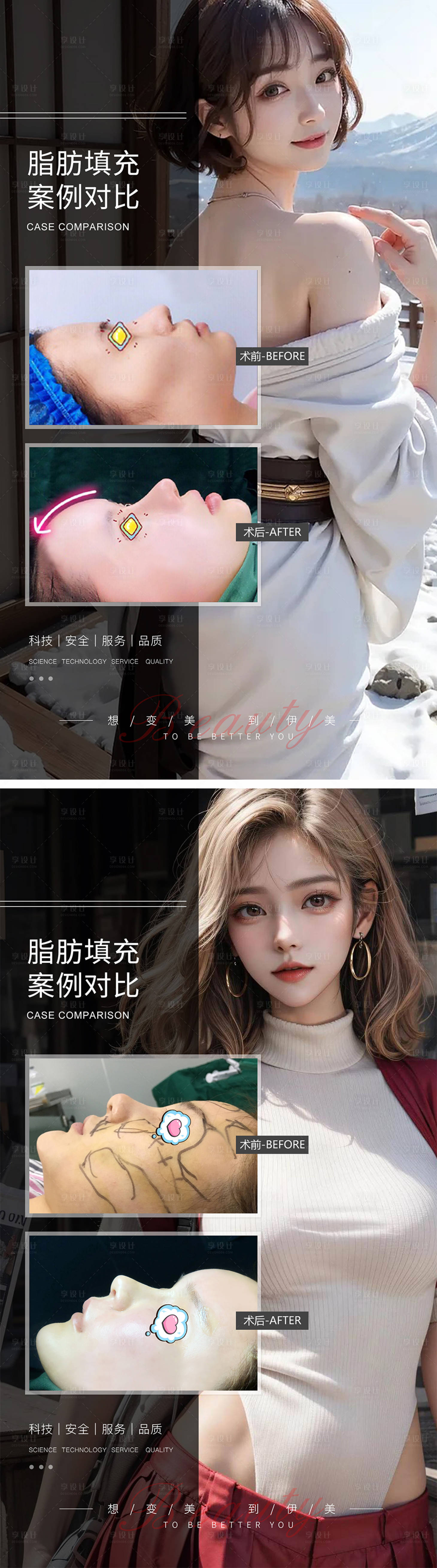 源文件下载【享设计】搜索编号：16410019332766819【面部脂肪填充案例对比】