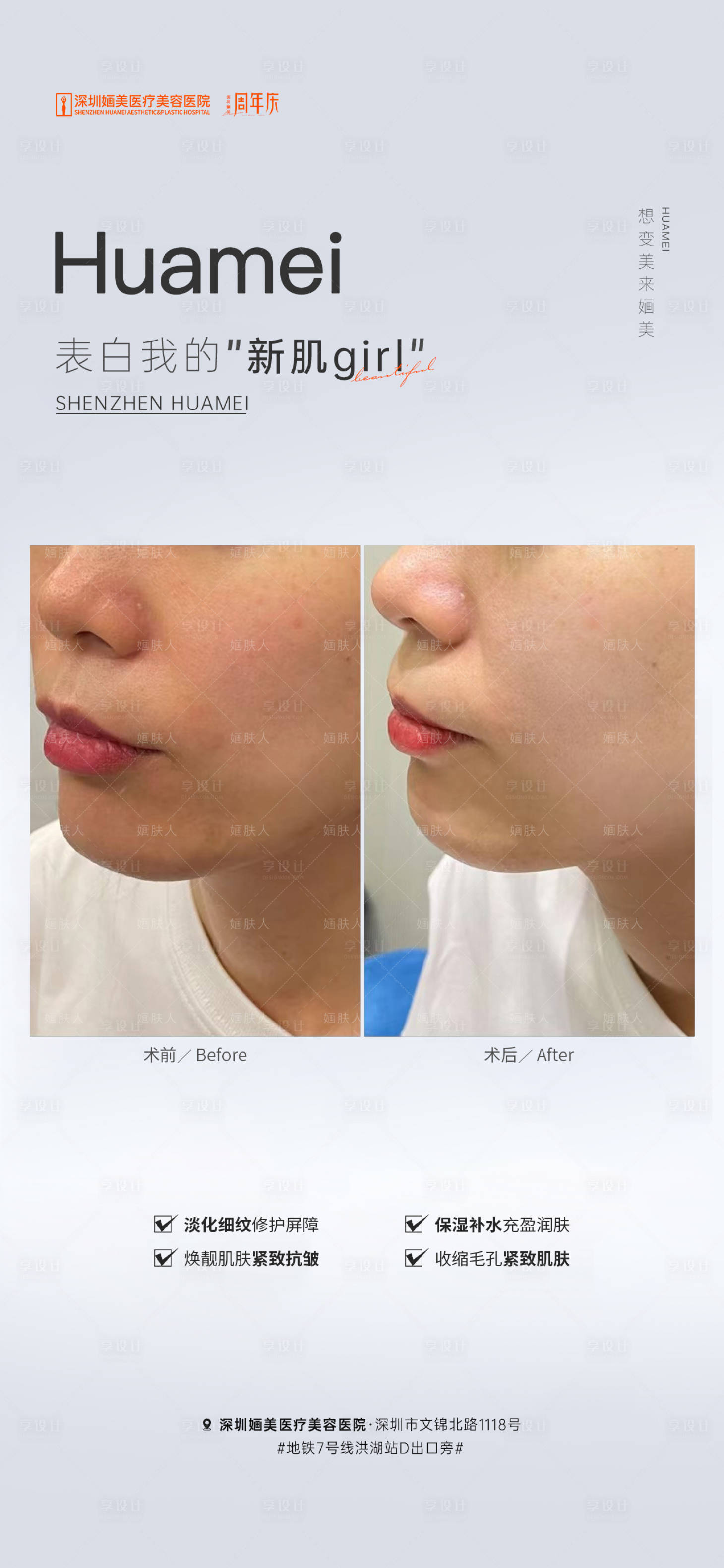 源文件下载【享设计】搜索编号：91420019311893201【医美案例海报】