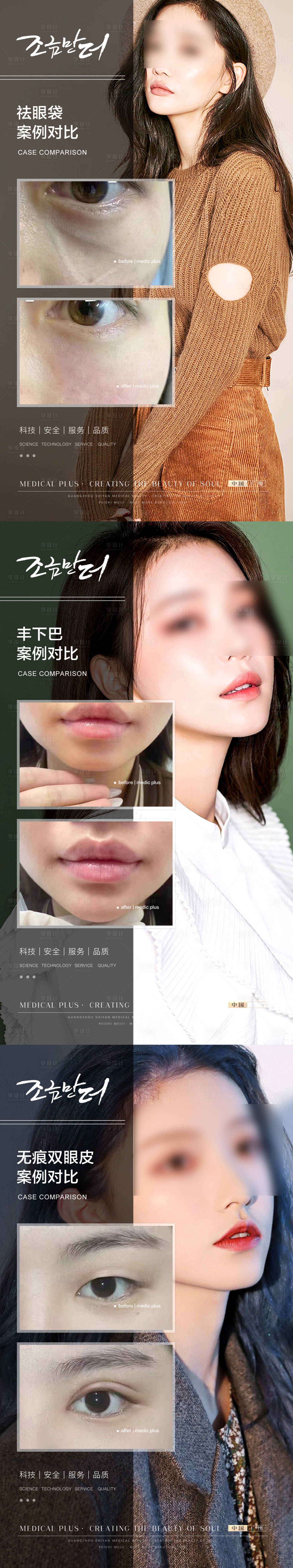 源文件下載【享設(shè)計】搜索編號：71050020111529537【醫(yī)美整形美容案例對比海報】