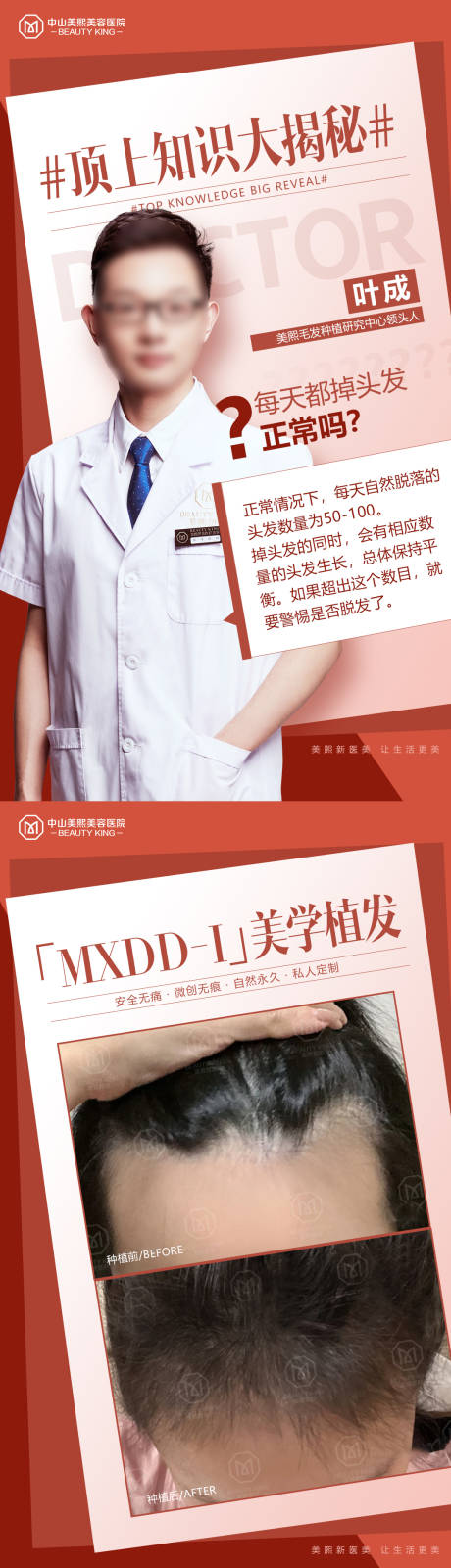源文件下载【享设计】搜索编号：23970020006601182【植发知识大揭秘长图海报】