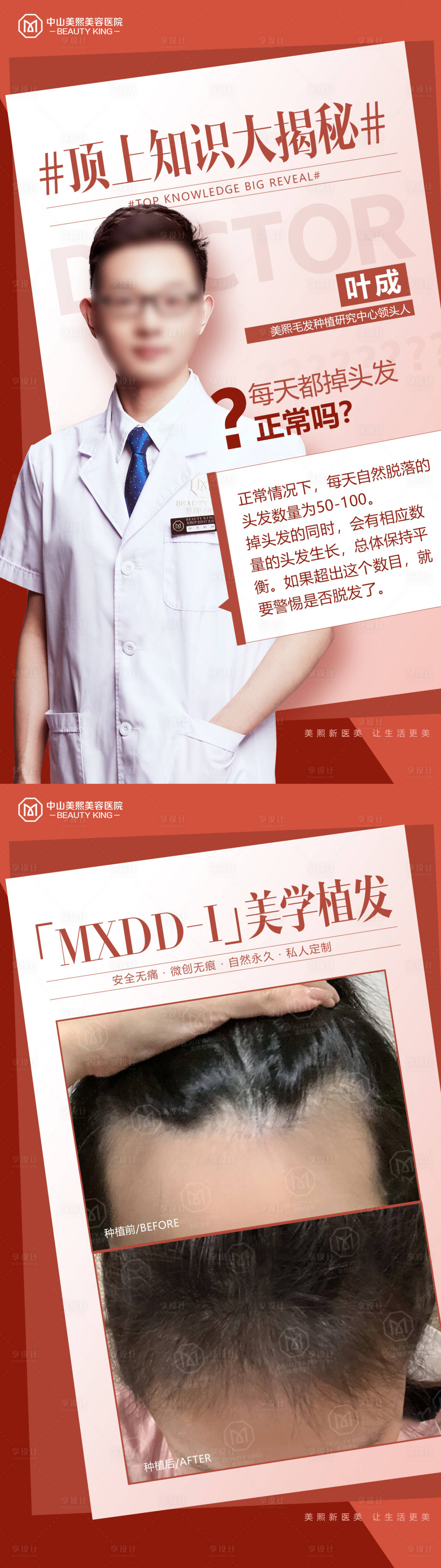 源文件下載【享設計】搜索編號：23970020006601182【植發知識大揭秘長圖海報】