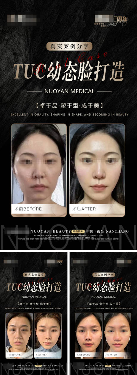 源文件下載【幼態(tài)臉案例】編號：22160019748848666