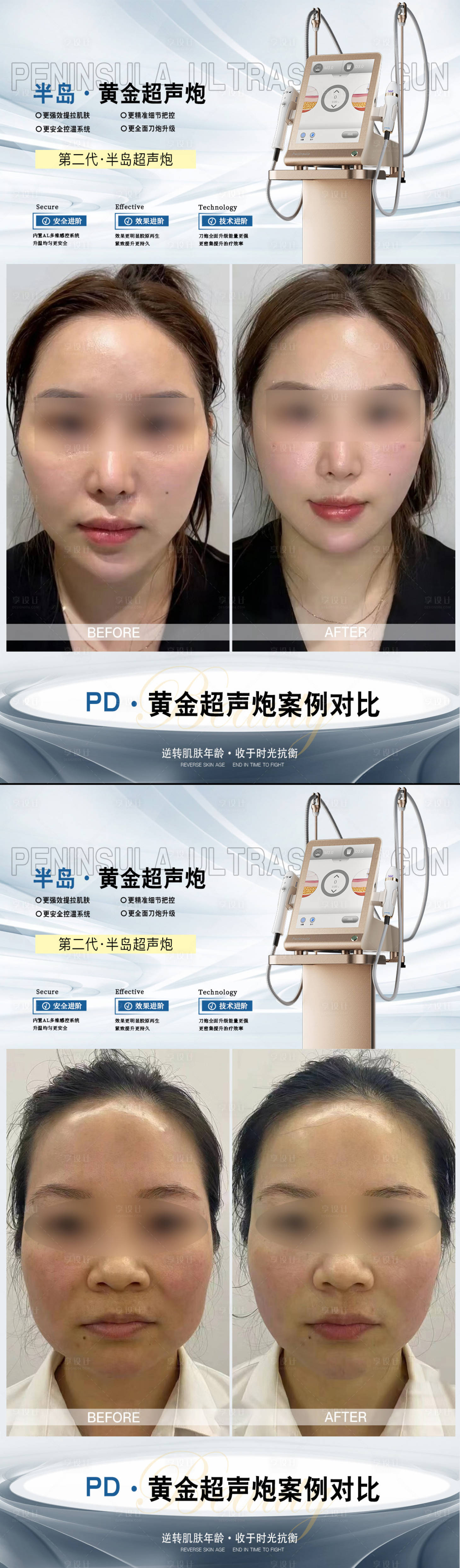 源文件下載【享設(shè)計(jì)】搜索編號(hào)：26910020046612239【超聲炮】