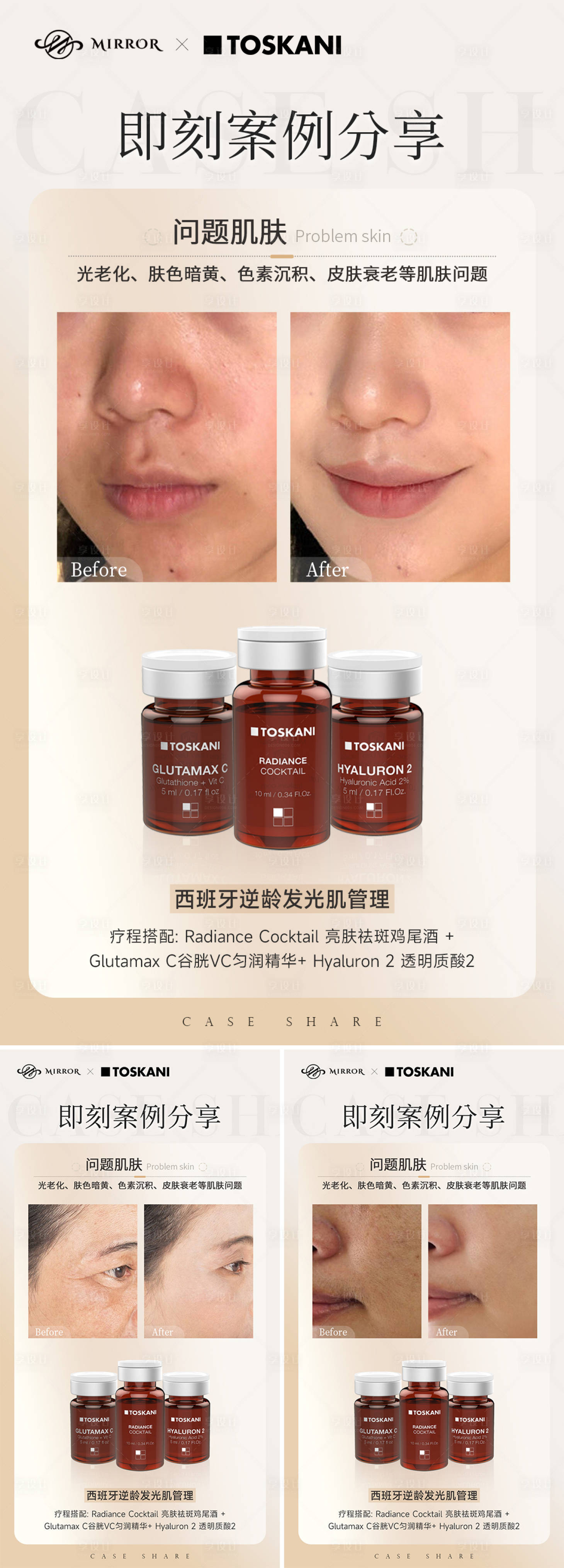 源文件下载【享设计】搜索编号：95730019664577263【案例对比海报】
