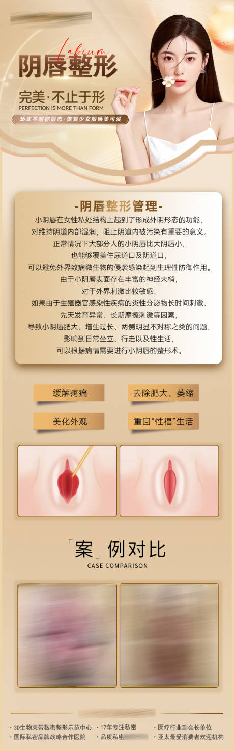 源文件下载【医美私密阴唇整形案例长图】编号：97900019745018306