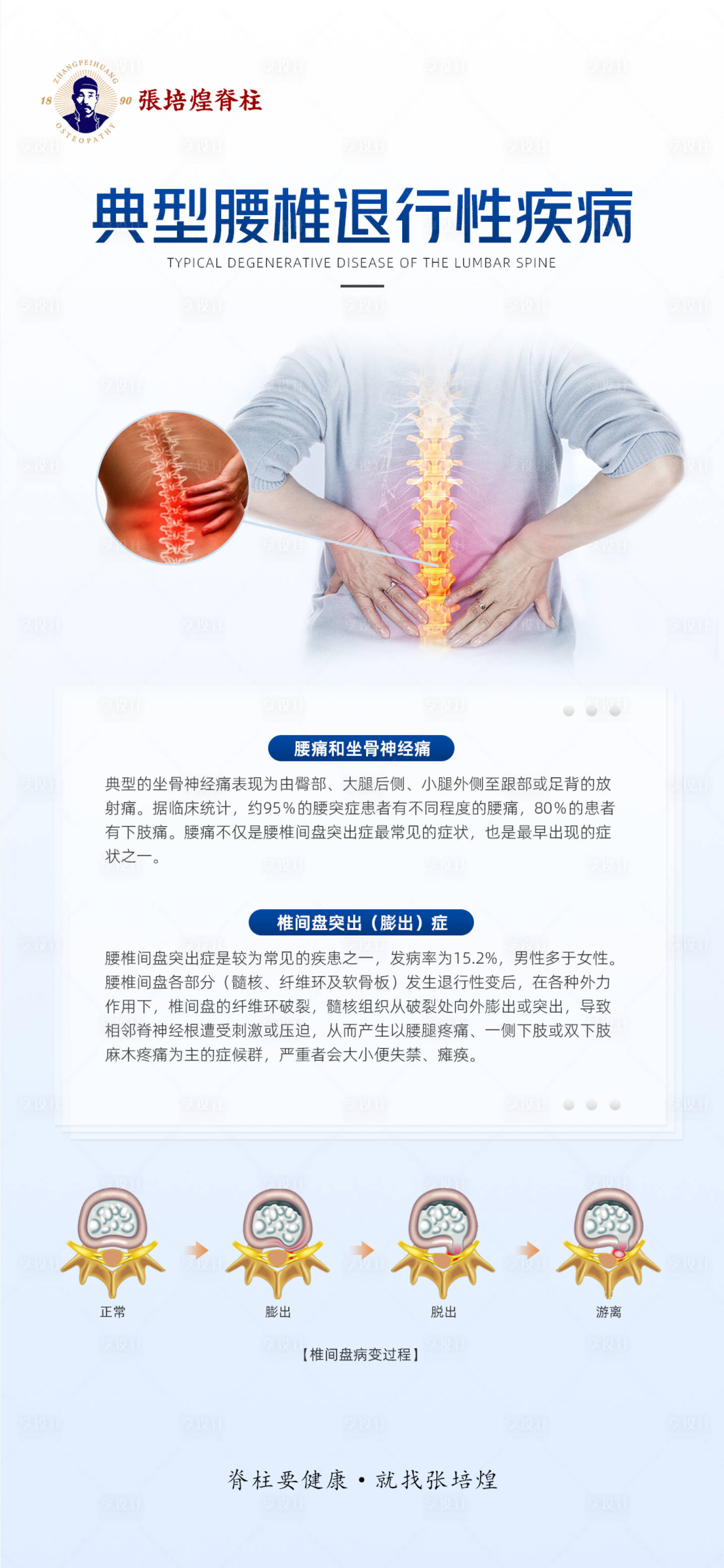 源文件下載【享設(shè)計(jì)】搜索編號(hào)：43250019901782305【脊柱項(xiàng)目科普宣傳海報(bào)】