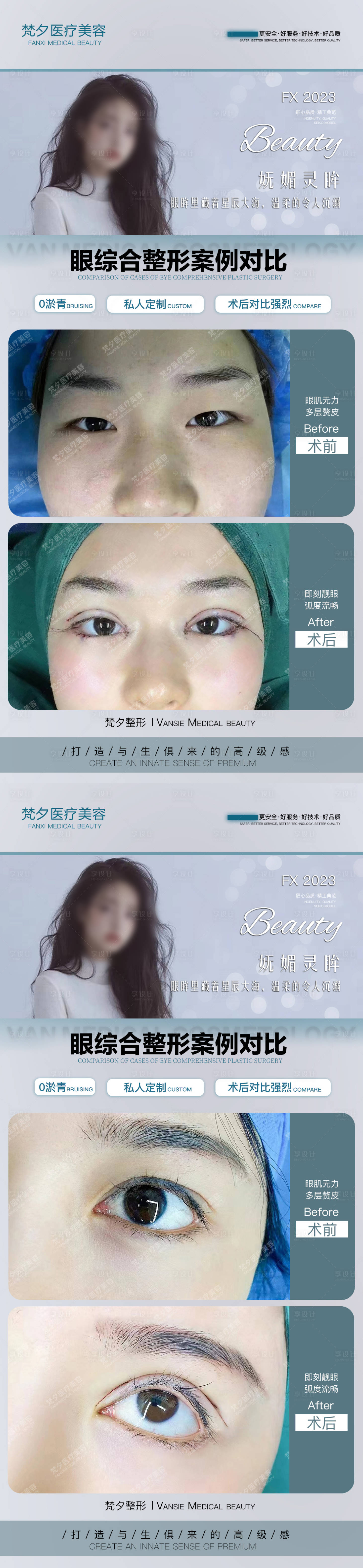 源文件下載【享設計】搜索編號：69200019860565924【眼綜合案例對比系列海報】