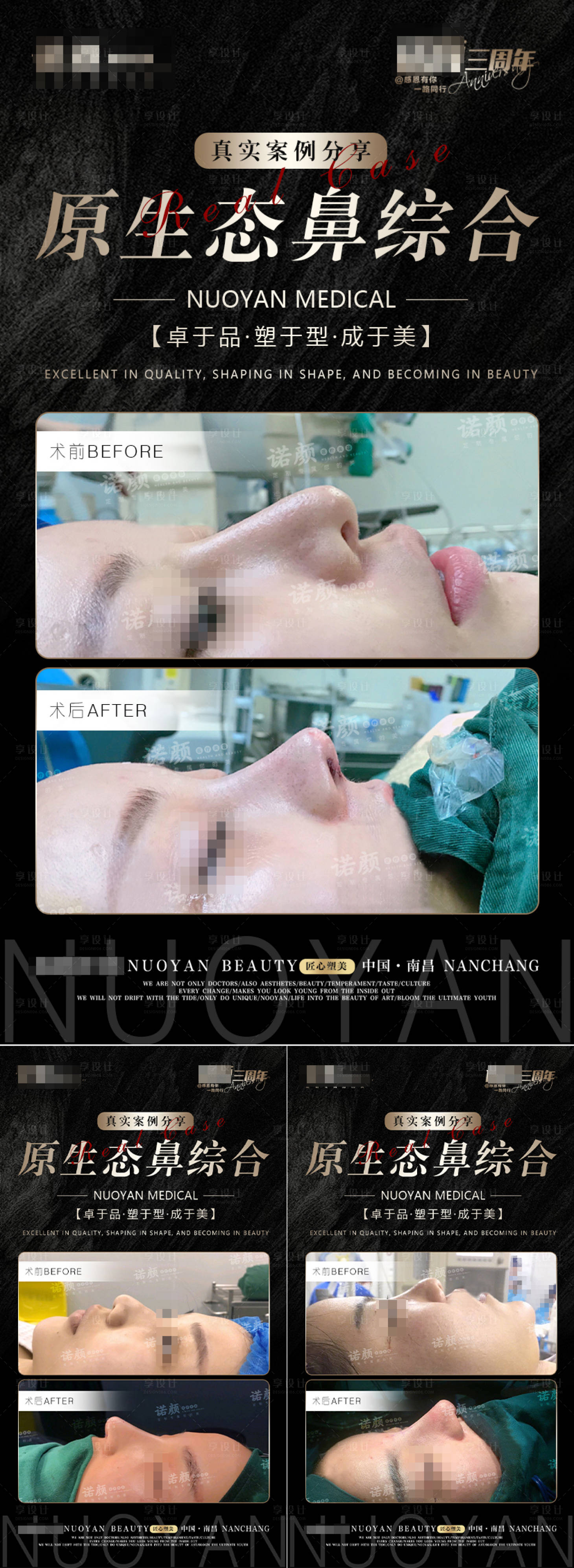 源文件下載【享設計】搜索編號：35640019652929358【鼻綜合案例海報】