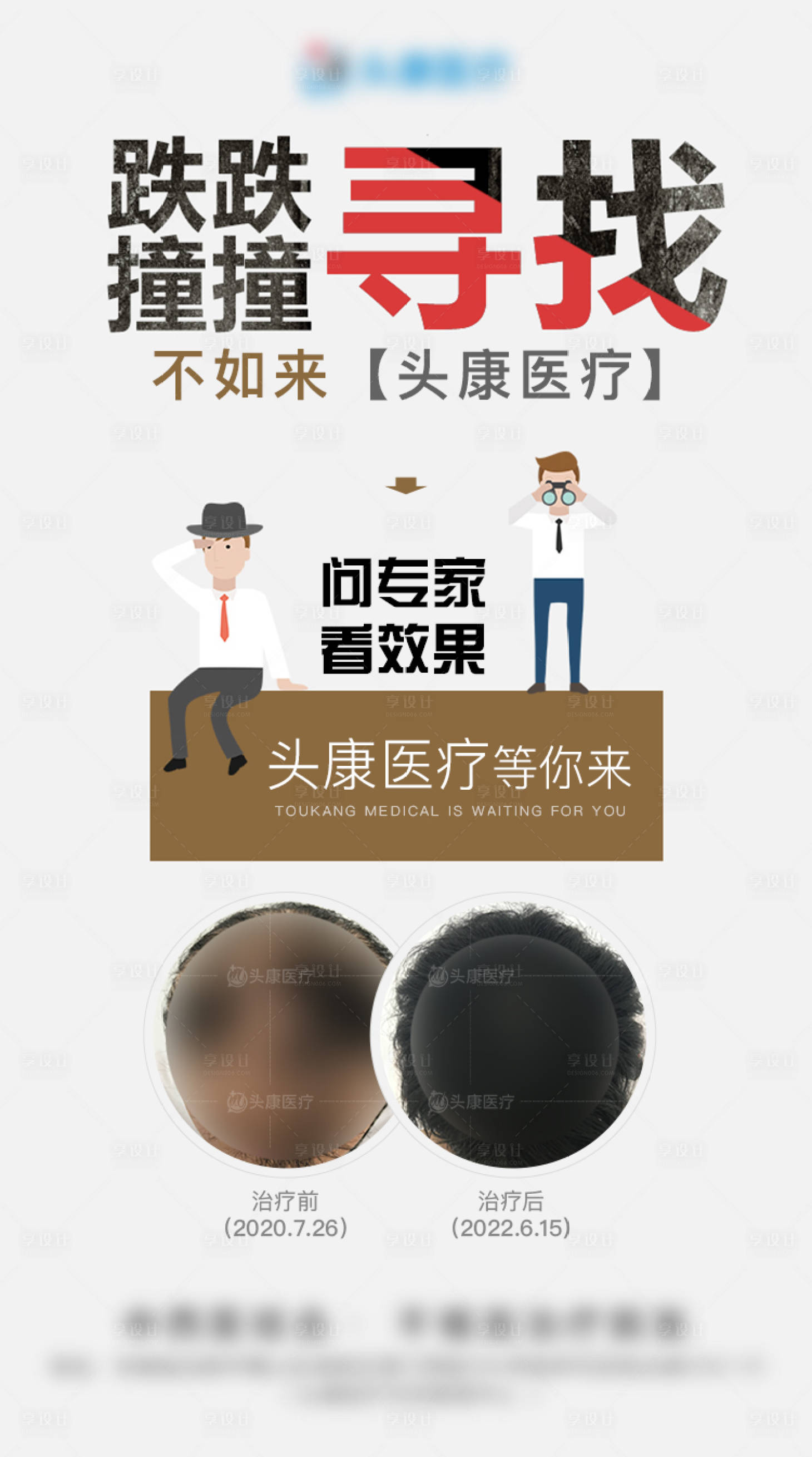 源文件下载【治疗脱发对比图海报】编号：49510019796333890