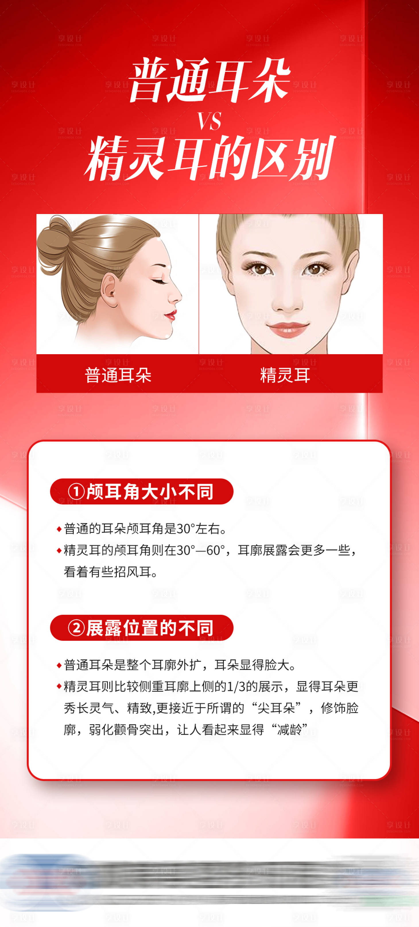 源文件下載【享設計】搜索編號：80420019952484515【醫(yī)美精靈耳海報】