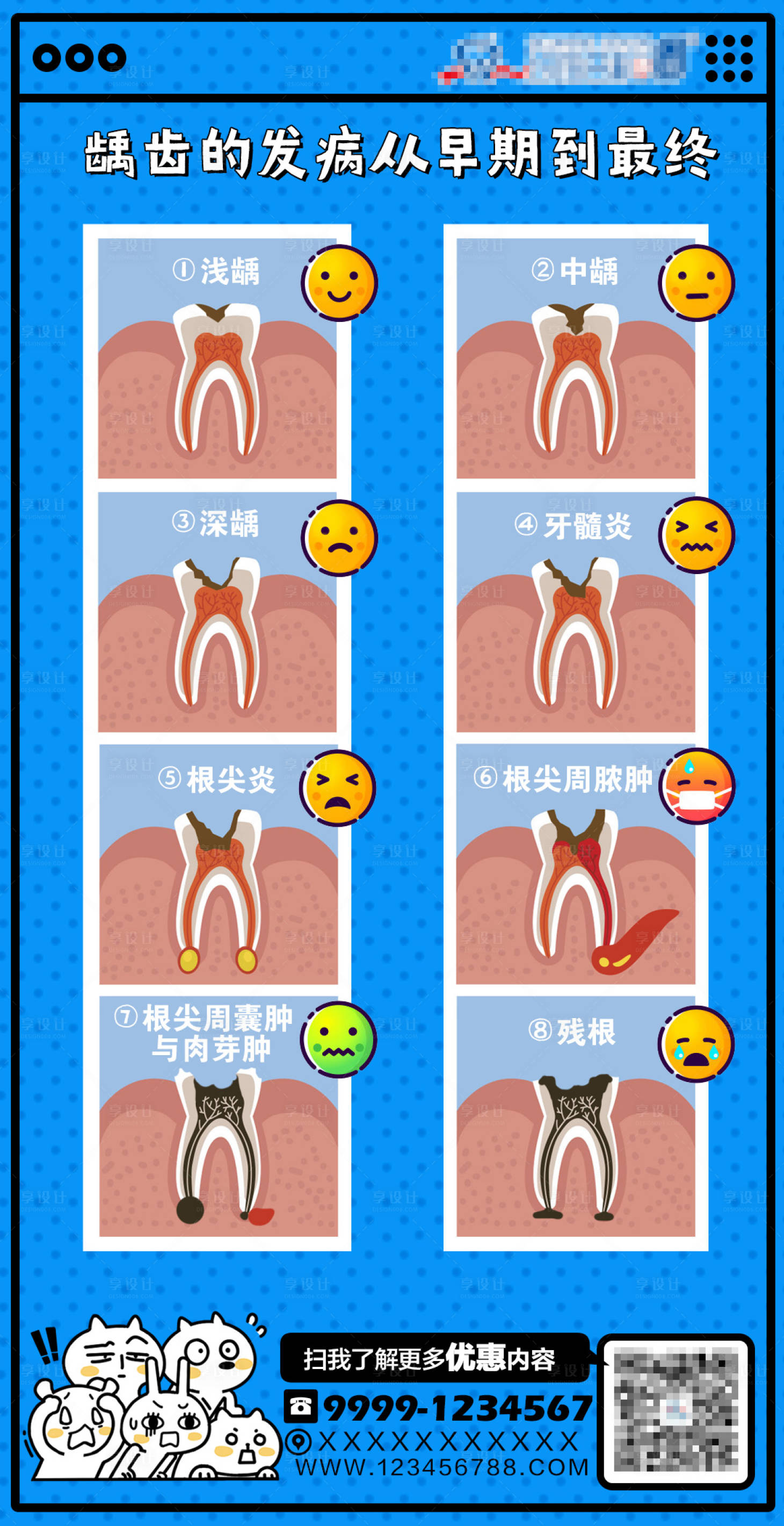 源文件下載【享設計】搜索編號：62890020007054354【齲齒過程海報】