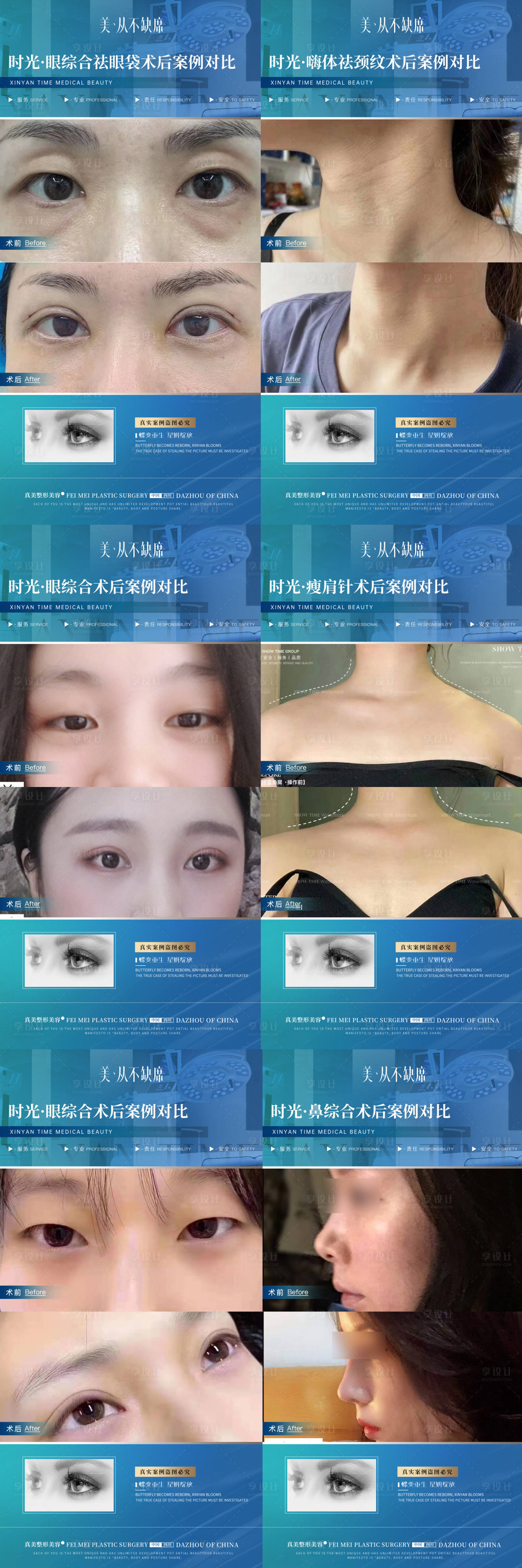 源文件下载【医美案例对比海报】编号：64350019666894405
