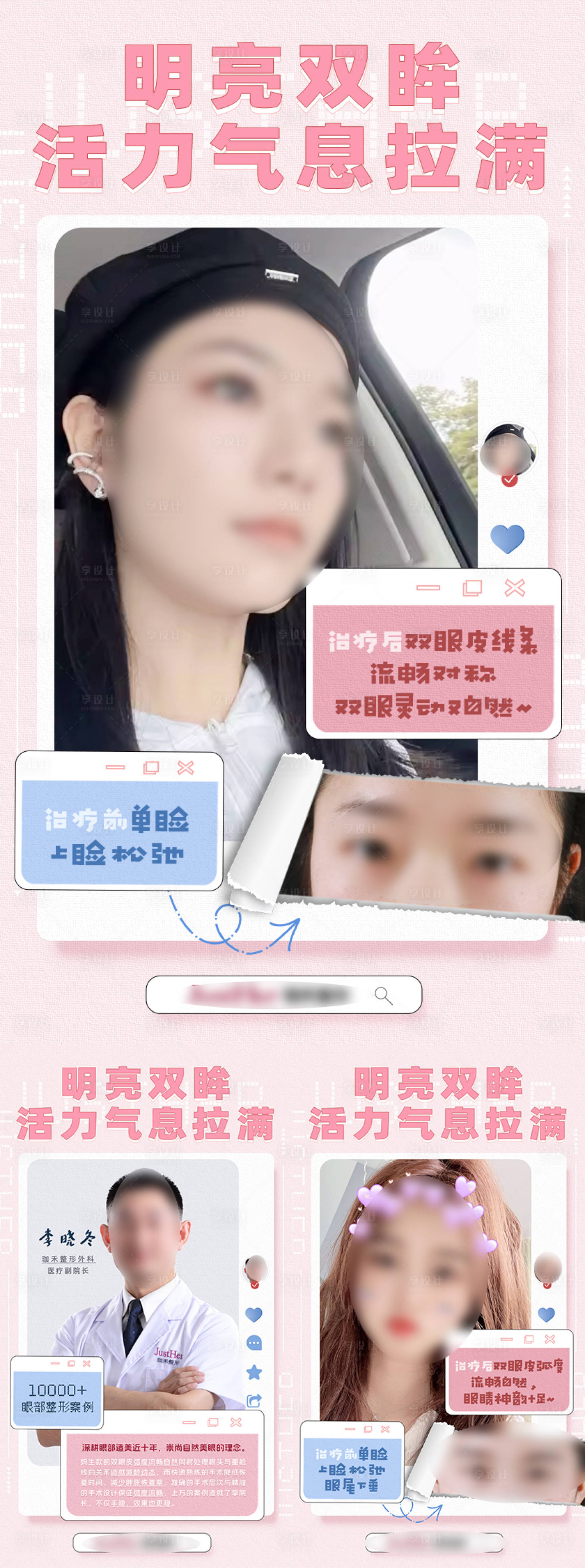 源文件下載【享設計】搜索編號：71830019919546628【雙眼皮案例對比海報】