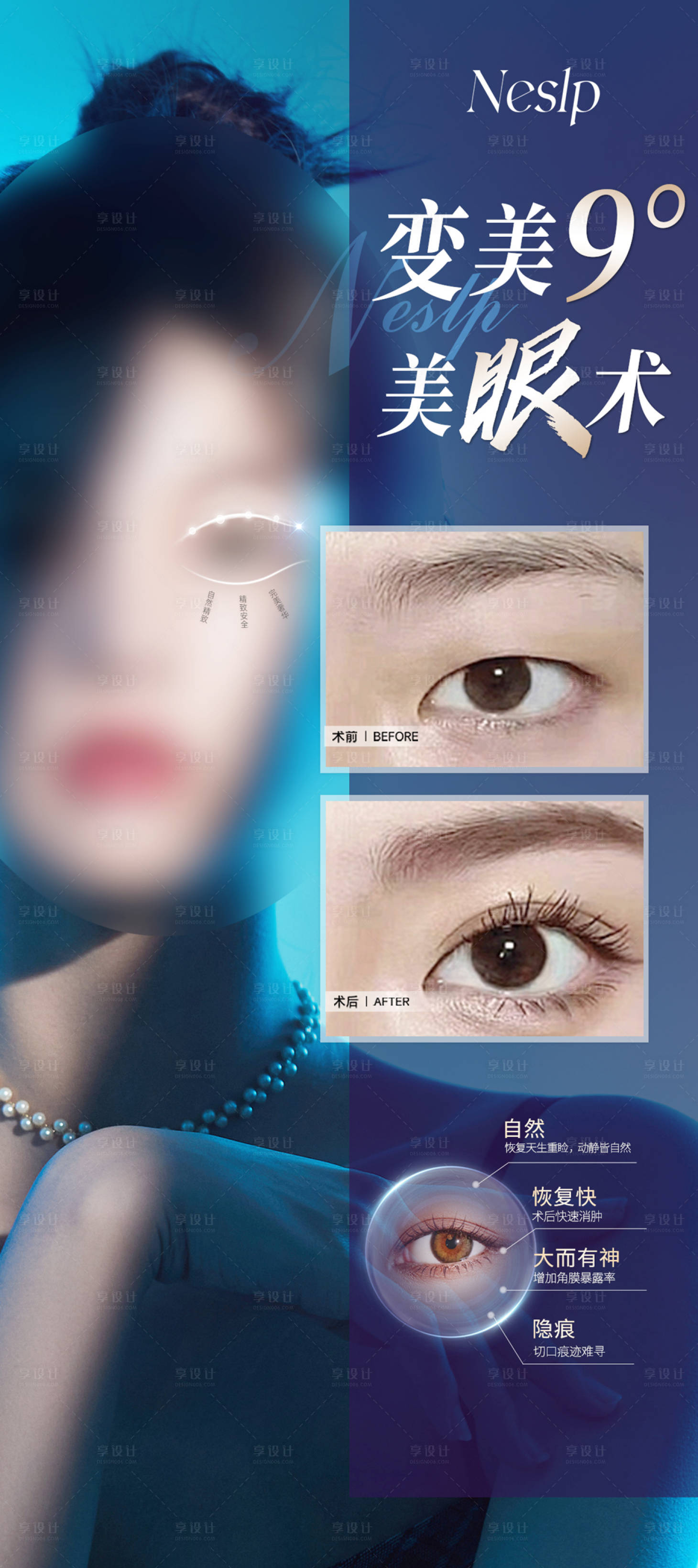 源文件下载【享设计】搜索编号：27460019642895019【医美美眼术】