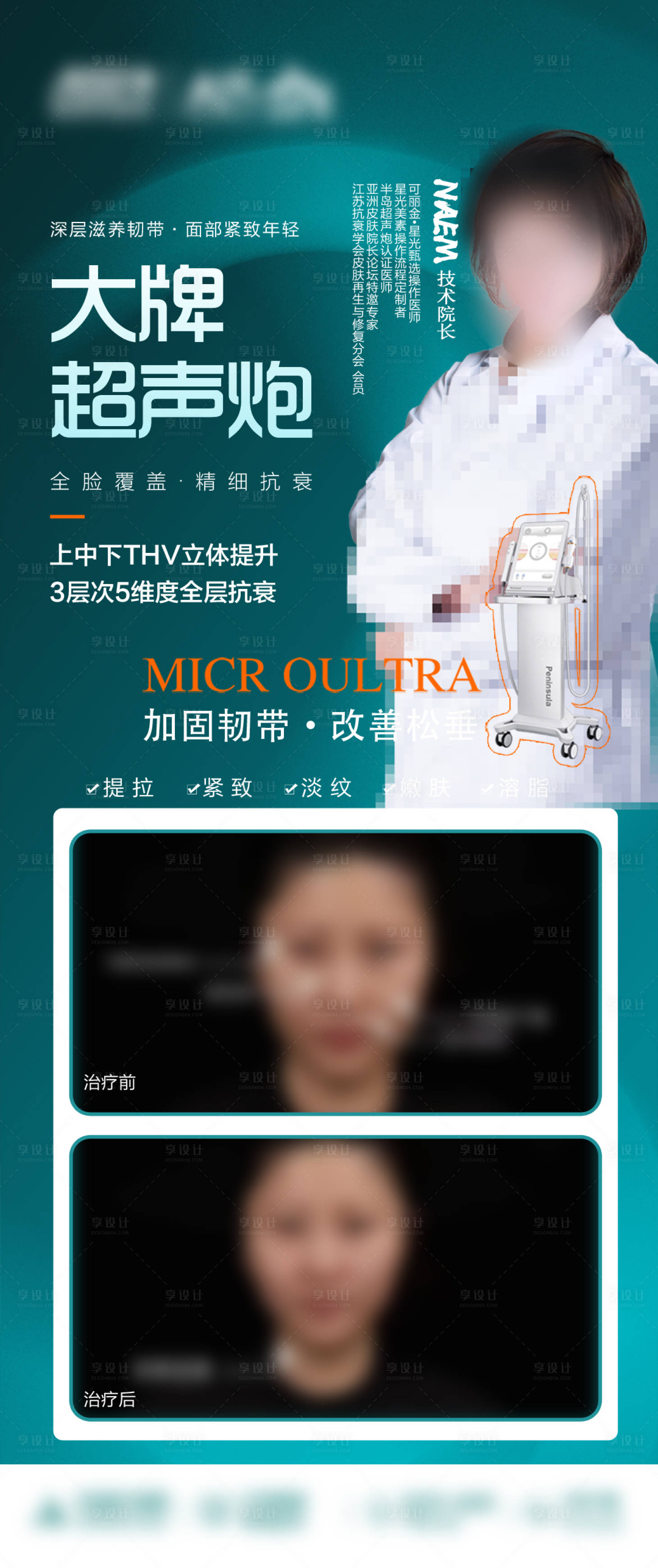 源文件下載【享設計】搜索編號：69050019639884974【超聲炮海報】