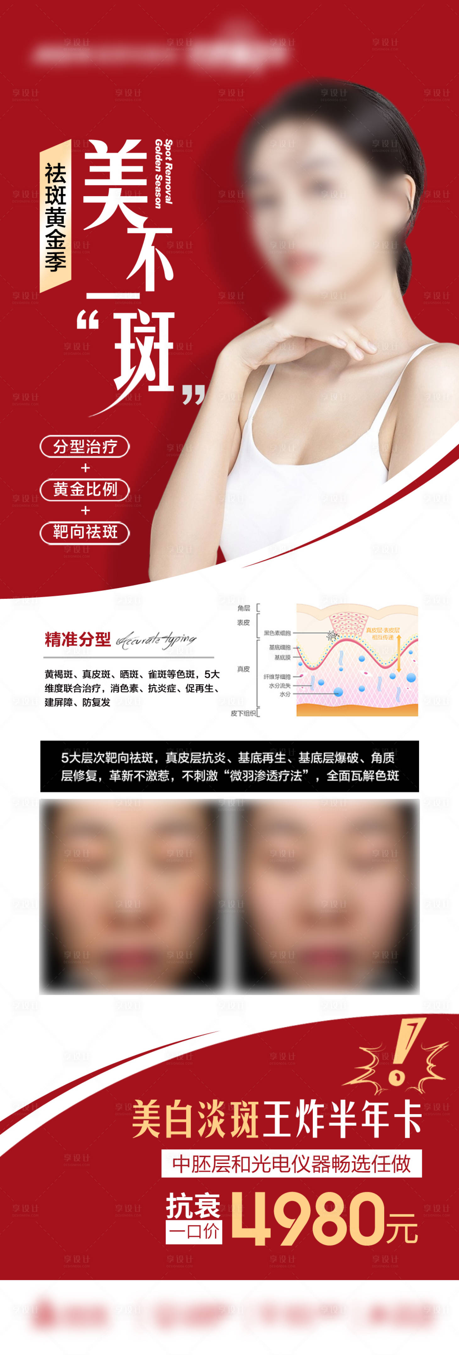 源文件下载【享设计】搜索编号：38380019743022985【时尚医美祛斑长图】