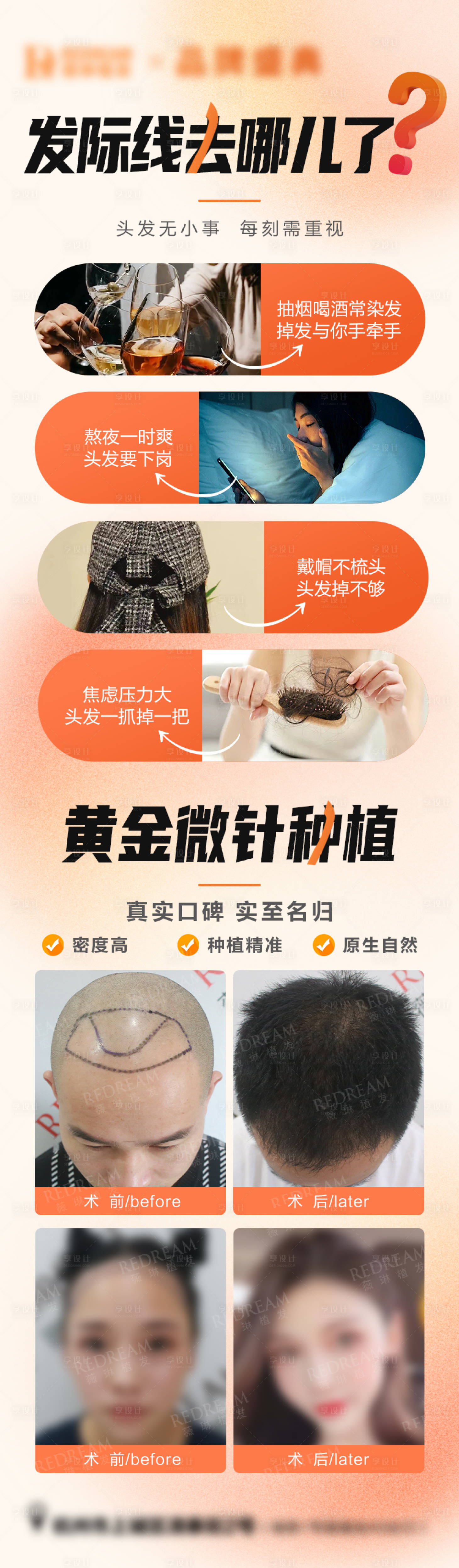 源文件下载【享设计】搜索编号：52380019961573186【植发简约案例海报】