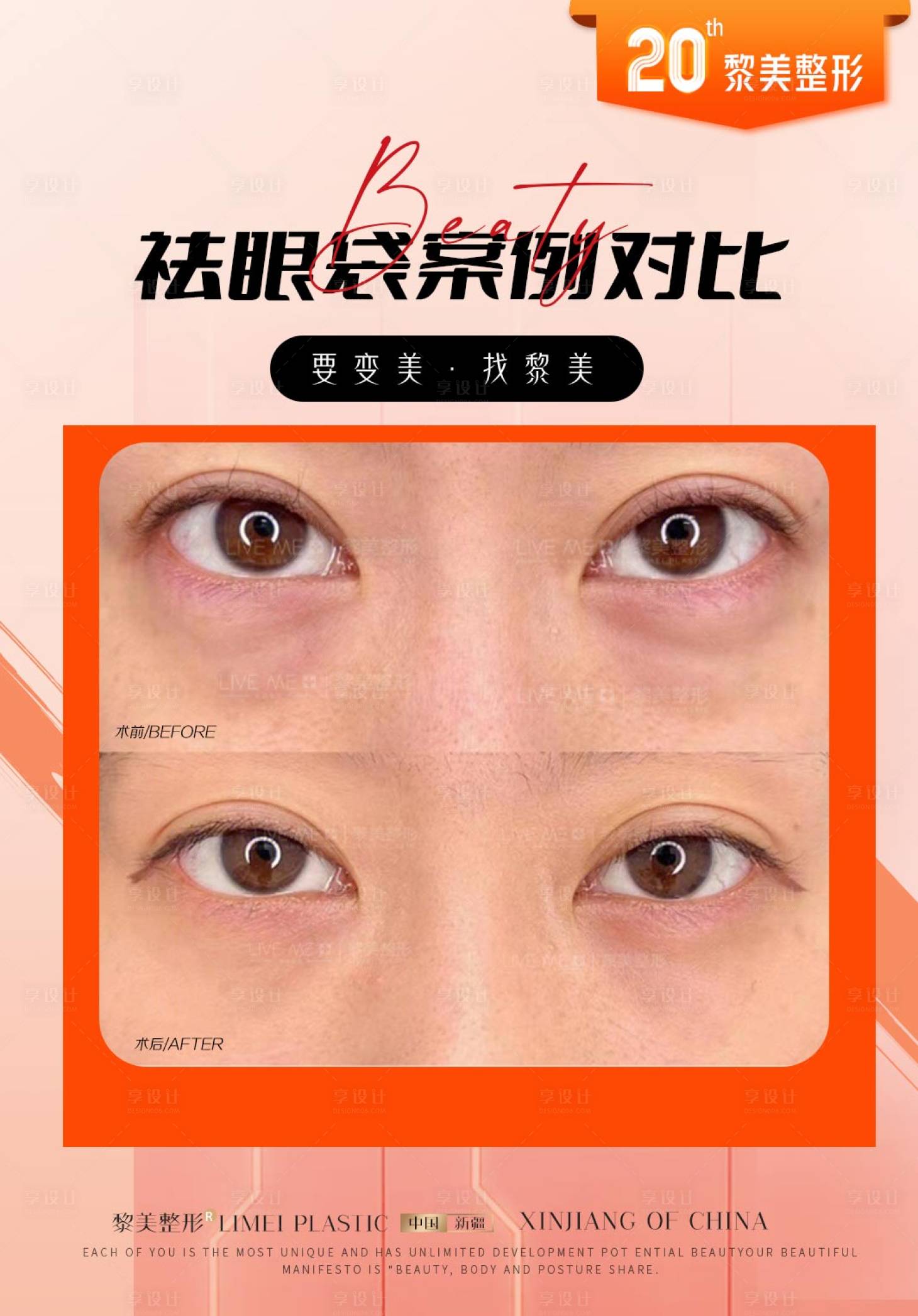 源文件下载【享设计】搜索编号：95380019913405325【医美案例海报】